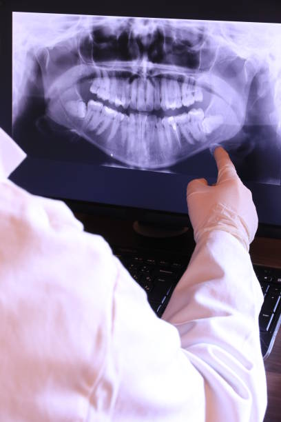Best Knocked-Out Tooth Emergency  in Pleasant Run Farm, OH